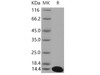 Mouse S100A5 Recombinant Protein (His Tag) (RPES2246)