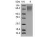Mouse CEACAM1/CD66a Recombinant Protein (His Tag) (RPES2253)