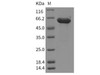 Mouse HEXB/Hexosaminidase B Recombinant Protein (His Tag) (RPES2265)