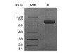 Mouse CD38 Recombinant Protein (RPES2280)