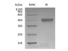 Mouse CD38 Recombinant Protein (RPES2299)