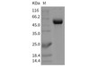 Mouse Siglec-2/CD22 Recombinant Protein (Fc Tag) (RPES2305)