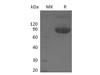 Mouse CD80/B7 Recombinant Protein (RPES2320)
