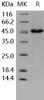 Human CD4/LEU3 Recombinant Protein (His Tag) (Active) (RPES2321)