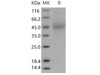 Mouse CD48 Recombinant Protein (His Tag) (Active) (RPES2326)