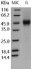Human CD16a/FCGR3A Recombinant Protein (RPES2327)