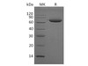 Alkaline Phosphatase/ALPL Recombinant Protein (RPES2329)