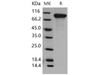 Mouse DDR2 Kinase/CD167b Recombinant Protein (His Tag) (Active) (RPES2334)