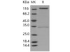 Human CD93/C1QR1 Recombinant Protein (Fc Tag) (RPES2343)