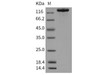 Mouse CHL Recombinant Protein (Fc Tag) (RPES2347)
