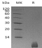 Human Polyubiquitin-B/UBB Recombinant Protein (RPES2354)