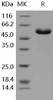 Human CD32a/FCGR2A Recombinant Protein (RPES2372)