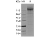 Human vWF Recombinant Protein (RPES2373)