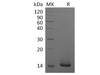 Human GM-CSF/CSF2 Recombinant Protein (E.coli) (Active) (RPES2386)