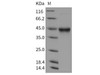 Mouse IL-5RA/IL-5 Ralpha Recombinant Protein (Baculovirus, His Tag) (Active) (RPES2391)