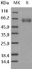 Human BACE1/ASP2 Recombinant Protein (His Tag) (Active) (RPES2435)