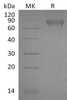 Mouse NgR/RTN4R Recombinant Protein (RPES2446)