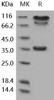 Human BACE1/ASP2 Recombinant Protein (Fc Tag) (Active) (RPES2456)