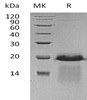Human APBA3 Recombinant Protein (RPES2461)