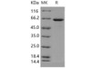 Human GBP1 Recombinant Protein (His Tag) (RPES2474)