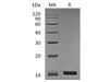 Human Angiogenin/ANG Recombinant Protein (RPES2481)