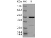 Human CDKN2D/p19ink4d Recombinant Protein (GST Tag) (Active) (RPES2494)