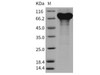 Mouse Granulin/GRN Recombinant Protein (His Tag) (RPES2498)