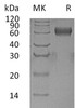 Human PSG1 Recombinant Protein (RPES2503)