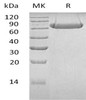 Human LAG3/CD223 Recombinant Protein (RPES2532)