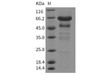 Mouse IGFBP-2/IGFBP2 Recombinant Protein (RPES2535)