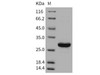 Carbonic Anhydrase 3/CA3 Recombinant Protein (RPES2553)