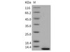 Mouse beta-NGF/Beta-NGF Recombinant Protein (Active) (RPES2556)