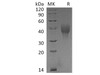 Cynomolgus OX40/TNFRSF4 Recombinant Protein (RPES2571)
