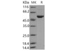 Human ALDH3A1 Recombinant Protein (Baculovirus, His Tag) (RPES2573)