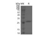 Human PF4V1 Recombinant Protein (Fc Tag) (RPES2593)