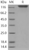 Human OSMR/IL31RB Recombinant Protein (aa 1-740, His Tag) (RPES2595)