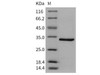 Human CA5A/CA-VA Recombinant Protein (RPES2596)