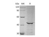 Human GALK1/Galactokinase Recombinant Protein (RPES2611)