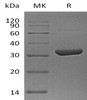 Human Annexin A10/ANXA10 Recombinant Protein (RPES2622)