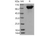 Mouse Periostin/POSTN Recombinant Protein (His Tag) (Active) (RPES2627)