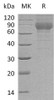 Mouse TEM7R/PLXDC2 Recombinant Protein (RPES2628)