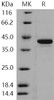 Human STK10/LOK Recombinant Protein (His Tag) (Active) (RPES2640)