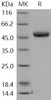Human Chitotriosidase/CHIT1 Recombinant Protein (RPES2657)