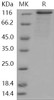 Human PRKD2/PKD2 Recombinant Protein (His & GST Tag) (Active) (RPES2662)