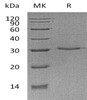 Human VSIG8 Recombinant Protein (RPES2668)