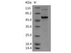 Mouse VDR/NR1I1 Recombinant Protein (His Tag) (RPES2681)