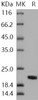 Human NME1/NDKA Recombinant Protein (RPES2683)