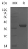 Human LMAN2/VIP36 Recombinant Protein (E.coli, His Tag) (RPES2719)