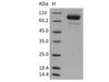 Mouse Coagulation Factor F2 Recombinant Protein (RPES2724)
