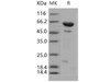 Human DUSP14/MKP-6 Recombinant Protein (His & MBP Tag) (RPES2740)